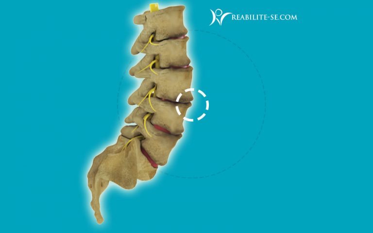 Osteofitose Reabilite Se Fisioterapia