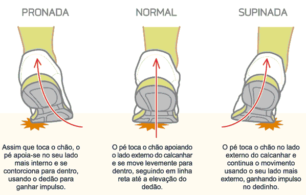 pisada neutra supinada e pronada